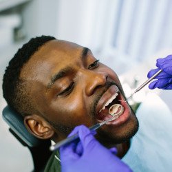 Man with black facial hair undergoing dental exam