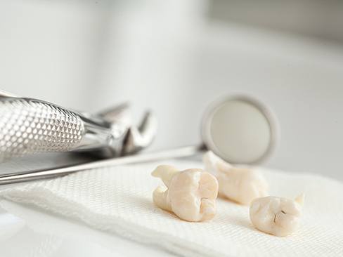 Clean teeth lying on napkin next to dental tool