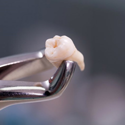 CLose-up of forceps holding tooth